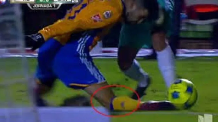 Stravična ozljeda nogometa&scaron;a zaprepastila cijeli svijet