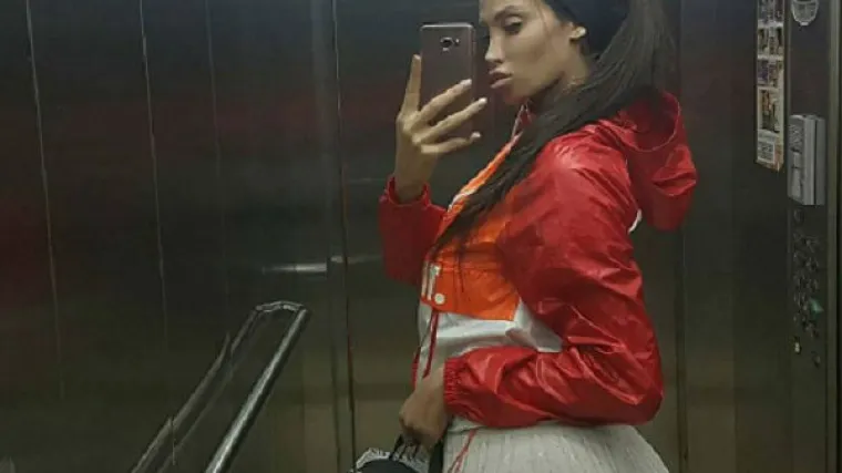 Sorajina guza predmet rasprava - je li riječ o operaciji ili Photoshopu?