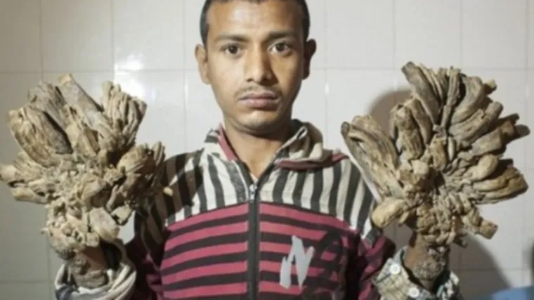 'A mislio sam da nikada vi&scaron;e neću moći držati kćer u rukama...'