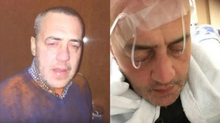 Agresivni kuhar nezadovoljan žalbom na hranu oslijepio čovjeka čilijem u prahu: 'Bilo je grozno!'