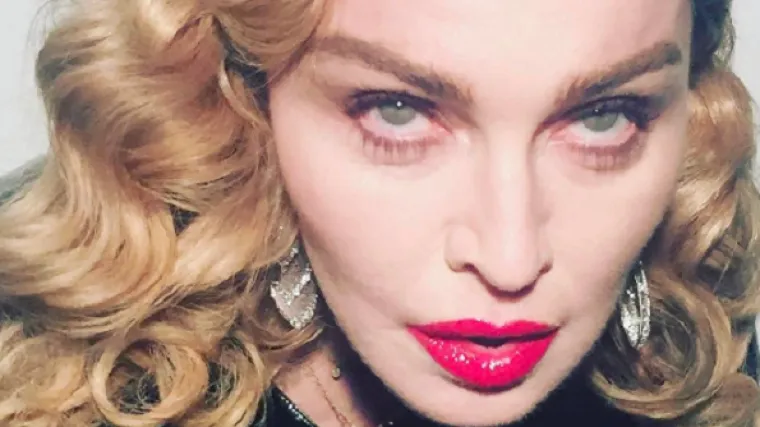 Madonna novim selfijem šokirala obožavatelje: 'Što ti se dogodilo s licem?!'