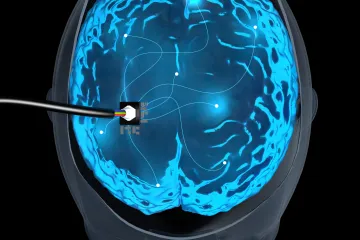 Gadna sjećanja moći će se izbrisati laserom