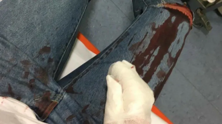 Ljudi u panici bježali kroz prozore, intervenirali Hitna i policija, ima i ozlijeđenih