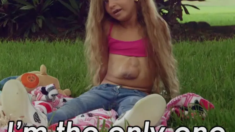 Čudesno: djevojčica živi normalno sa srcem izvan grudnog ko&scaron;a