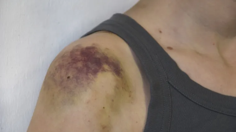 'Satima su me tukli zavezanog za radijator'