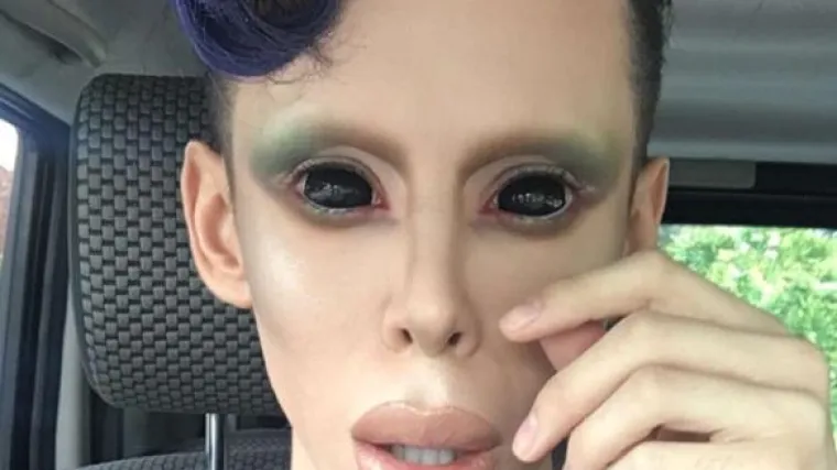 Dosad se operirao 110 puta: 'Želim postati bespolni izvanzemaljac'