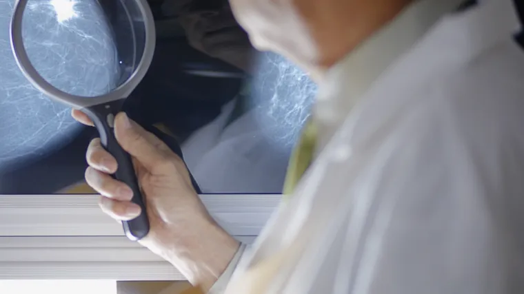 Na mamografiju pozvali ženu koja je umrla prije &scaron;est godina