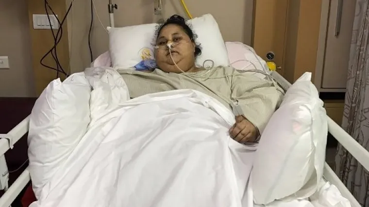  Najteža žena na svijetu nakon operacije izgubila 100 kg