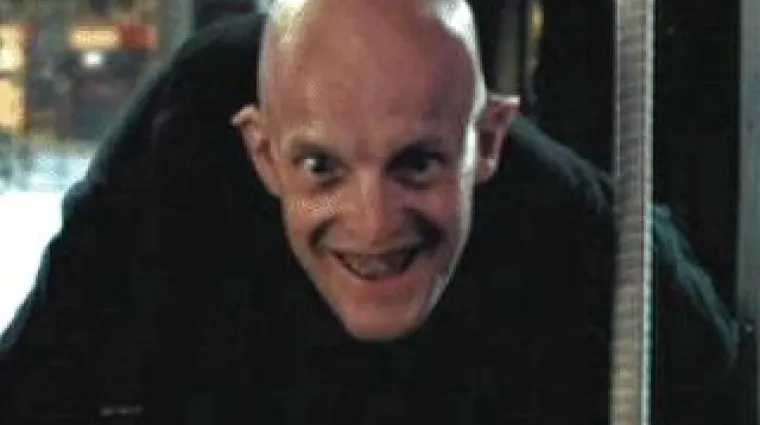 Te&scaron;ko je stradao u nesreći, objavljene i potresne fotografije iz bolnice