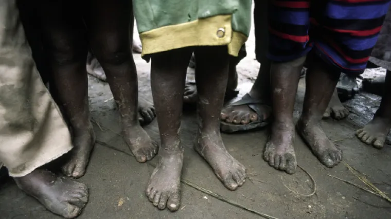 Izostanak testiranja djece na HIV znači da će mnogi umrijeti u zapadnoj i sredi&scaron;njoj Africi