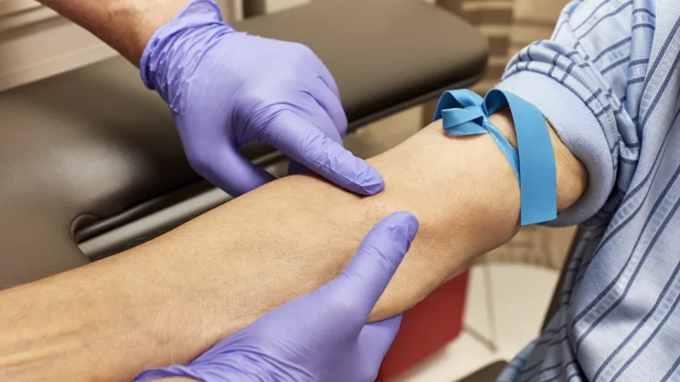 Novi krvni test otkriva potencijalnu bolest kod pacijenta tri godine prije pojave simptoma