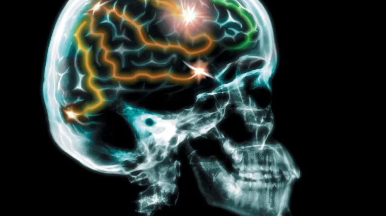 'Musk razvija tehnologiju 'dowloadanja' misli u mozak'