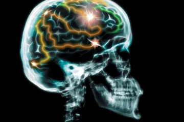 'Musk razvija tehnologiju 'dowloadanja' misli u mozak'