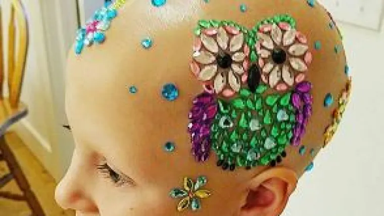 Usprkos bolesti: ćelava djevojčica odu&scaron;evila najljep&scaron;om frizurom