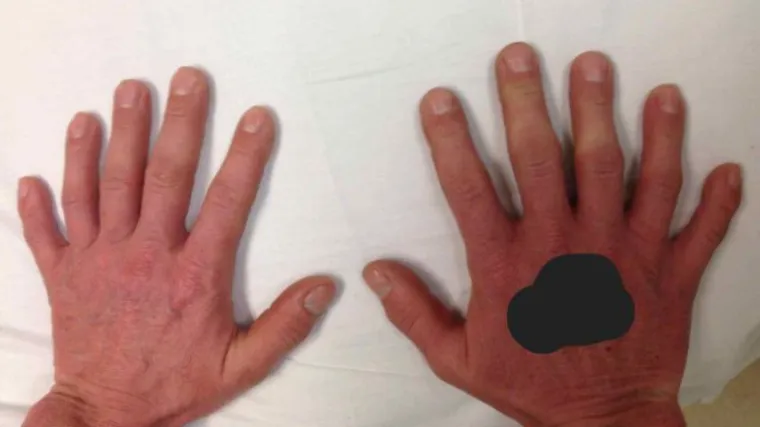 Liječnik objavio fotografiju kako bi pokazao da poremećaj nije rijedak kao &scaron;to se misli