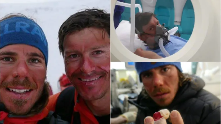 Kostelić završio u barokomori, njegovom prijatelju prijeti amputacija prsta