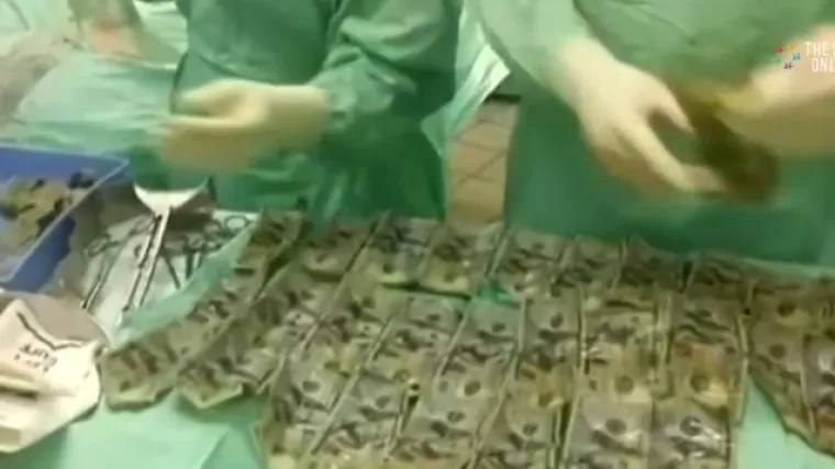 Bizarna reakcija nakon bračne svađe: Kolumbijka progutala 7.000 dolara!