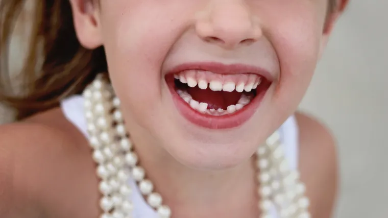 Redoslijed nicanja zubi: kojim redom izbijaju mliječni zubi