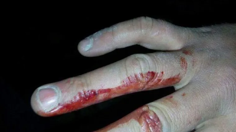 Inicijative 'Dobrodo&scaron;li' i 'Are you syrious': 'Hrvatska policija vr&scaron;i nasilje nad izbjeglicama'