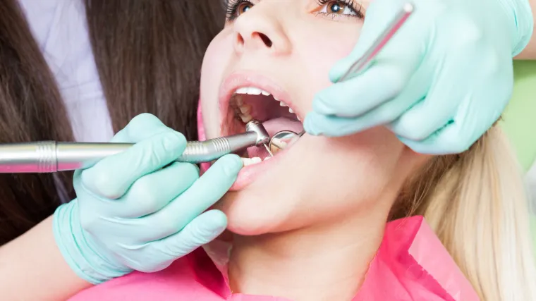 Čišćenje kamenca sa zubi: kako izgleda postupak?