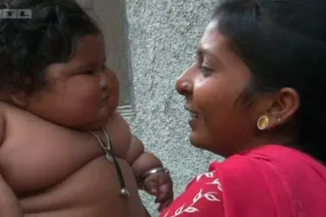 Ima samo osam mjeseci, a teži nevjerojatnih 17. 2 kilograma! Znaju li liječnici što joj je?