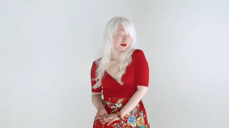 Osjećajte se dobro u svojoj koži: Ovu ženu ni njezina genetika nije mogla zaustaviti