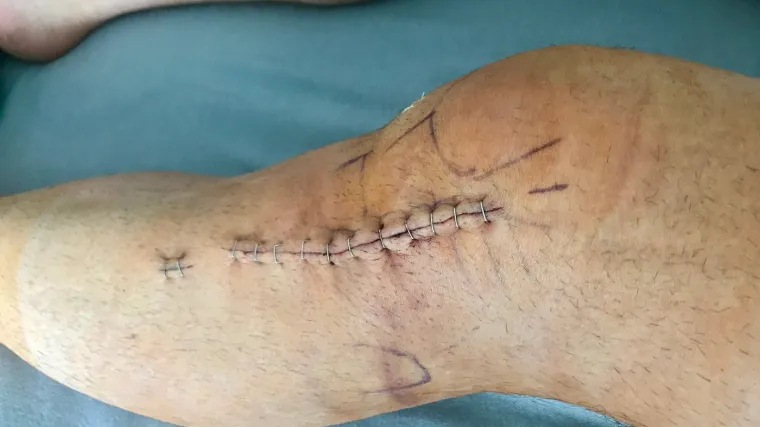 'Koljeno mi se savija po sredini i radi probleme osiguranju na aerodromu, ali barem je nehrđajuće'