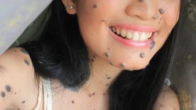 Prekrasna djevojka s bezbroj dlakavih madeža potencijalna je nova Miss Universe Malezije