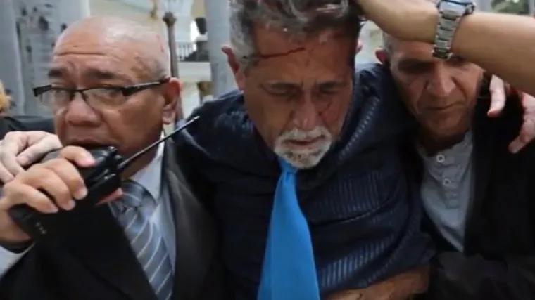 Krvava lica oporbe: vladini prista&scaron;e upali u venezuelski parlament i napali zastupnike