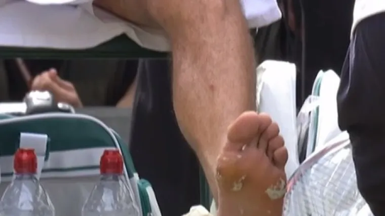 Pogledajte kako izgleda Čilićevo izranjavano stopalo