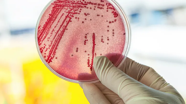 Znanstvenici otkrivaju za&scaron;to su bakterije sve otpornije