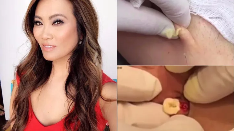 Kontroverzna dermatologinja otkriva trikove uz koje se oni više neće vraćati