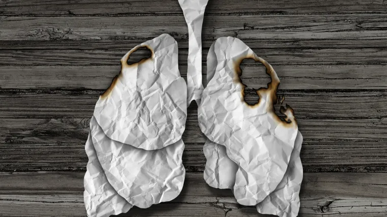 Znanstvenici korak do razvijanja testa daha za rano otkrivanje raka pluća