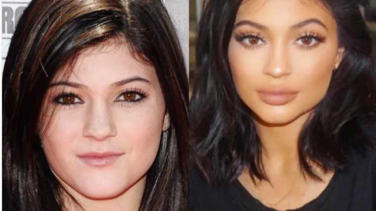 Postoji li poznata osoba bez korekcije izgleda? 10 najskupljih plastičnih operacija, od nekih cifri boli glava