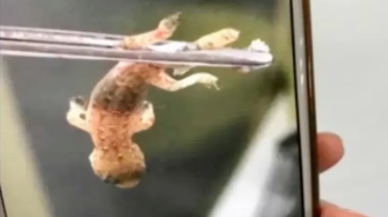 Liječnici mu&scaron;karcu izvadili 'monstruma' iz uha, ali gdje je nestao rep?