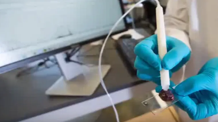 Olovka koja postavlja dijagnozu dodirom u bolnicama od sljedeće godine