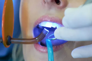 Ovaj napredak u stomatologiji znači da više nećemo morati trpjeti nesnosna liječenja zuba