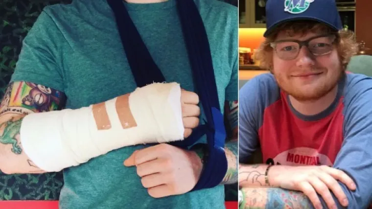 Glazbenika udario automobil dok se vozio biciklom, njegova turneja je upitna