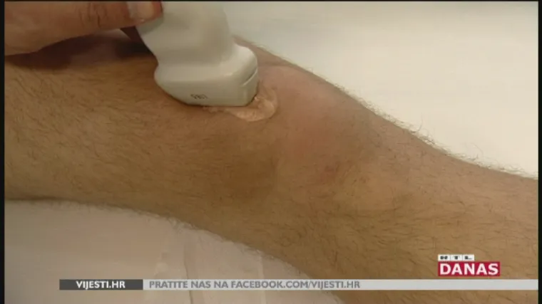 Novi uspjeh hrvatskih liječnika: među prvima u Europi primijenili novu metodu za liječenje osteoartritisa