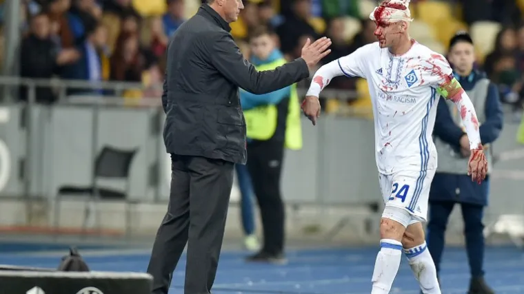 Liječnik otkrio stanje Vatrenog nakon ozljede koja je obi&scaron;la svijet