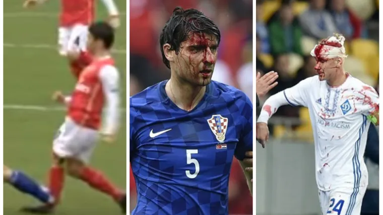 Vida je nastavio niz u kojem odjekuje Eduardovo ime