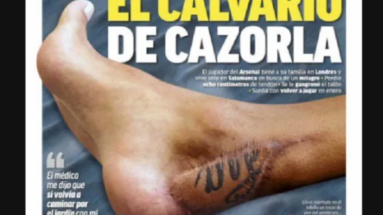 Cazorla nakon infekcije umalo ostao bez noge