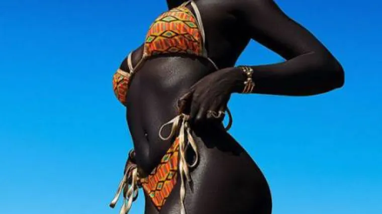 Zbog svoje boje kože postala je planetarno popularna