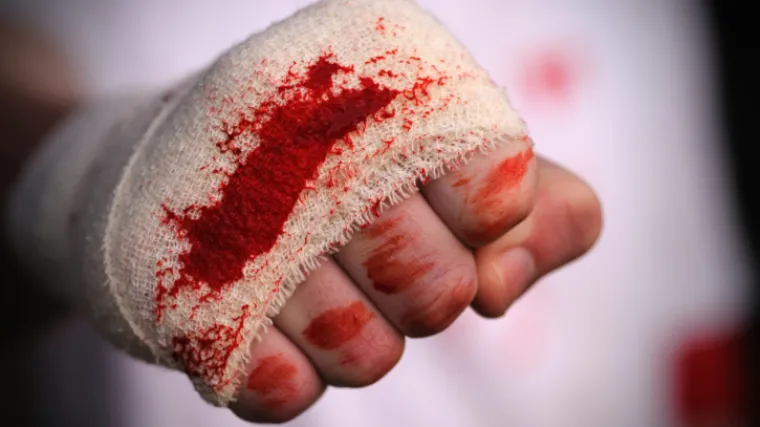 Brutalan napad u Karlovcu: &scaron;etao s unukom i naletio na nasilnika koji mu je slomio nos, sada će dobiti on, ali po 'džepu'