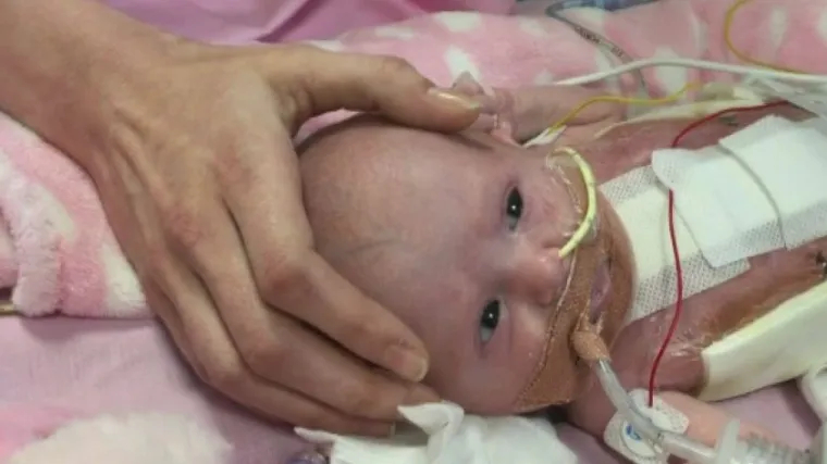 Božićno čudo u Britaniji: majku nagovarali na pobačaj, ona rodila bebu sa srcem izvan tijela koja je uspjela preživjeti