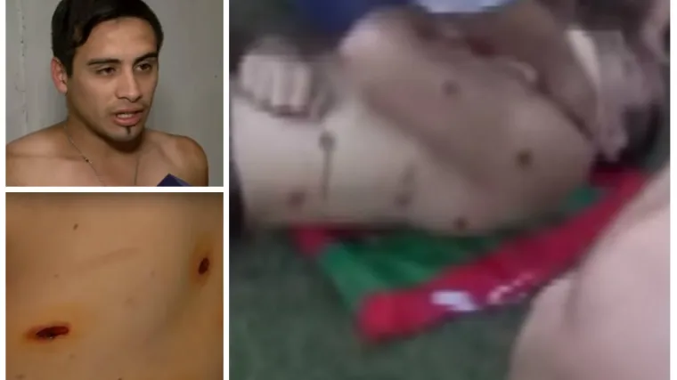 Stra&scaron;no, leđa su mu puna ožiljaka. Pogođen je 16 puta