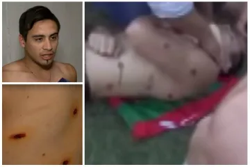 Stra&scaron;no, leđa su mu puna ožiljaka. Pogođen je 16 puta