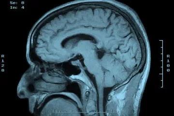 Ova obitelj ne osjeća bol, znanstvenici kod njih otkrili nevjerojatne stvari