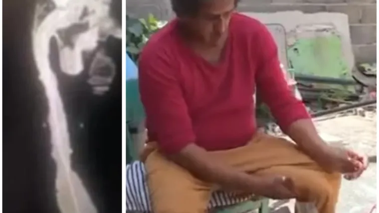 Dug mu je tek 17 cm, ne želite znati &scaron;to je ostatak