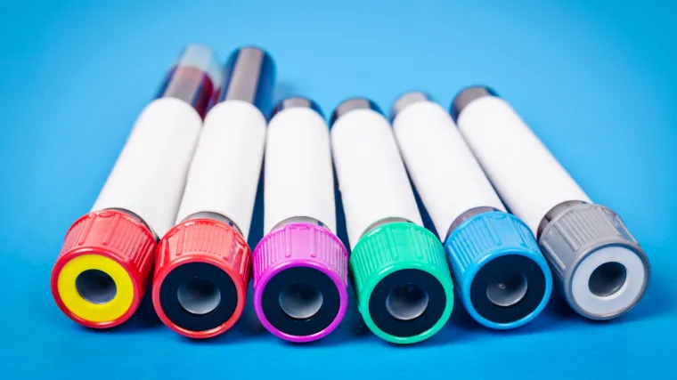 Krvni test za rak koji bi mogao spasiti mnoge živote - bližimo li se cilju?